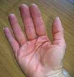 fingernails